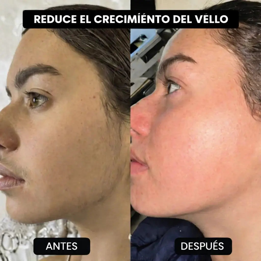 Cyperus Rotundus Oil – Menos crecimiento, menos irritación